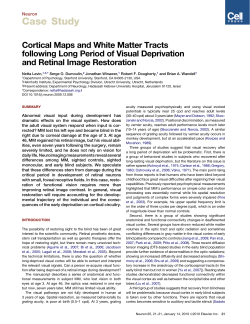 Cortical maps and white matter tracts following long period of visual