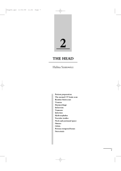 THE HEAD