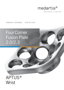 Four Corner Fusion Plate 2.0/2.3 APTUS&reg; Wrist