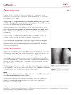 Osteochondroma - OrthoInfo