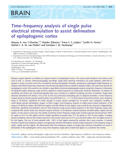 Time–frequency analysis of single pulse