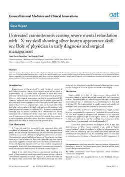 Evaluation of use of wells criteria and D-dimer
