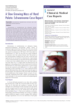 A Slow Growing Mass of Hard Palate