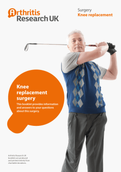 Knee replacement surgery