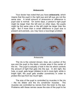 Anisocoria Your doctor has noted that you have anisocoria, which