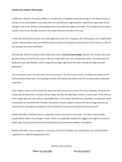 Proliferative diabetic retinopathy