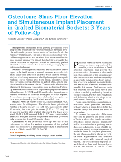 Osteotome Sinus Floor Elevation and Simultaneous Implant