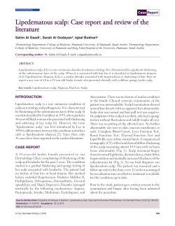 Lipedematous scalp - Our Dermatology Online