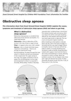 Obstructive sleep apnoea - Great Ormond Street Hospital