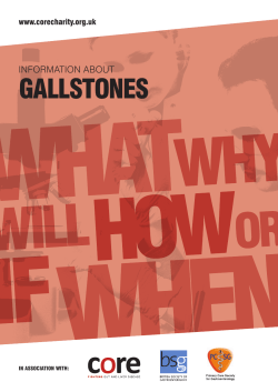 Information about Gallstones
