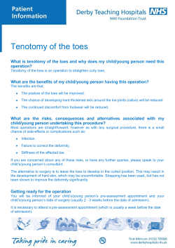 Tenotomy of the toes - Derby Teaching Hospitals NHS Foundation