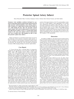 Posterior Spinal Artery Infarct