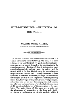 On supra-condyloid amputation of the thigh.