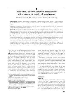 Real-time, in vivo confocal reflectance microscopy of