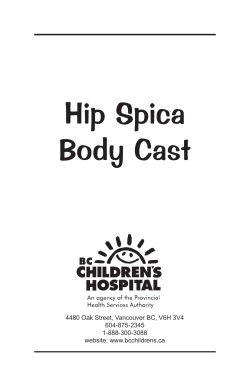 Hip Spica Body Cast