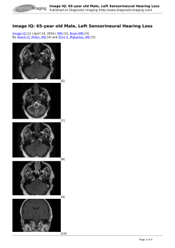Image IQ: 65-year old Male, Left Sensorineural Hearing Loss