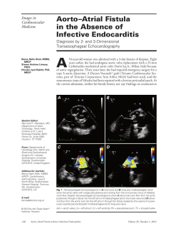 Aorto&ndash;Atrial Fistula in the Absence of Infective Endocarditis