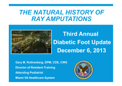 the natural history of ray amputations