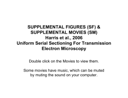 SUPPLEMENTAL MOVIES (SM)