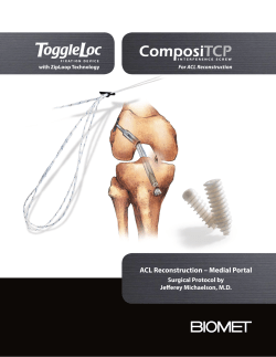 ACL Reconstruction &ndash; Medial Portal
