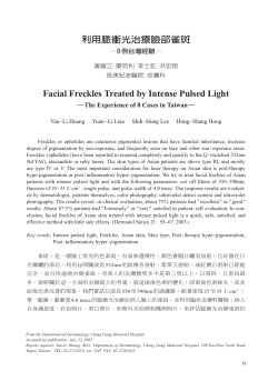 Facial Freckles Treated by Intense Pulsed Light