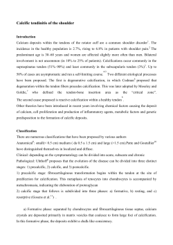 Calcific tendinitis of the shoulder