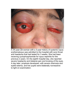 A 34-year-old woman with a 3-year history of systemic lupus