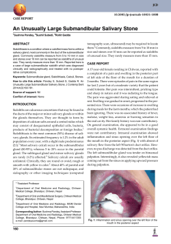 An Unusually Large Submandibular Salivary Stone
