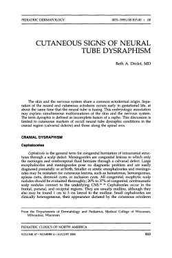 cutaneous signs of neural tube dysraphism