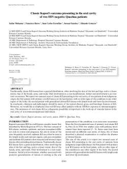 Classic Kaposi`s sarcoma presenting in the oral cavity of two HIV
