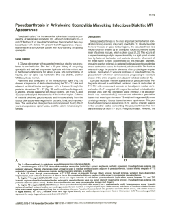 Pseudoarthrosis in Ankylosing Spondylitis Mimicking Infectious Diskitis