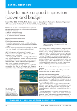 How to make a good impression (crown and bridge)