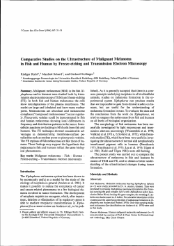 Comparative Studies on the Ultrastructure of Malignant Melanoma in