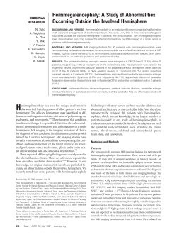 Hemimegalencephaly: A Study of Abnormalities Occurring Outside