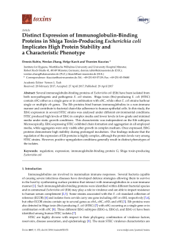 Distinct Expression of Immunoglobulin