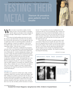 Titanium rib procedure gives patients room to breathe