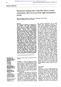 Extinction duringtime controlled direct retinal stimulation