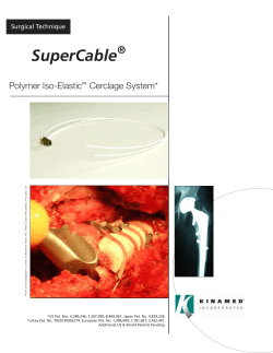 SuperCable Surgical Technique