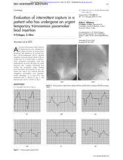 Evaluation of intermittent capture in a patient who has undergone an