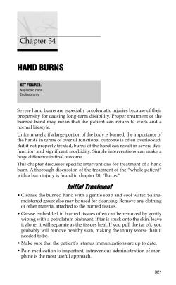 Hand Burns - practical plastic surgery