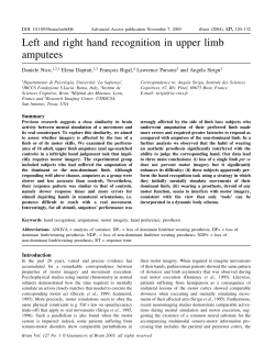 Left and right hand recognition in upper limb amputees