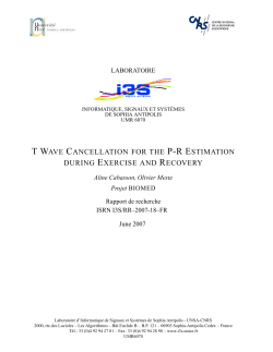 t wave cancellation for the pr estimation during