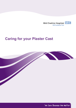 Caring for your Plaster Cast - Mid Cheshire Hospitals NHS