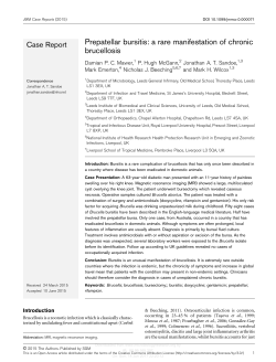 Prepatellar bursitis: a rare manifestation of