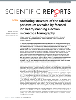 Anchoring structure of the calvarial periosteum revealed by focused