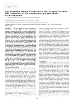 Spatiotemporal imaging of human brain activity using functional MRI