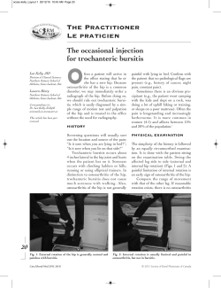 The occasional injection for trochanteric bursitis