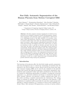 Fast Fully Automatic Segmentation of the Human Placenta from