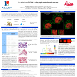 Localization of HDAC1 using high resolution microscopy