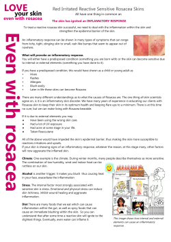 Rosacea skin hand out